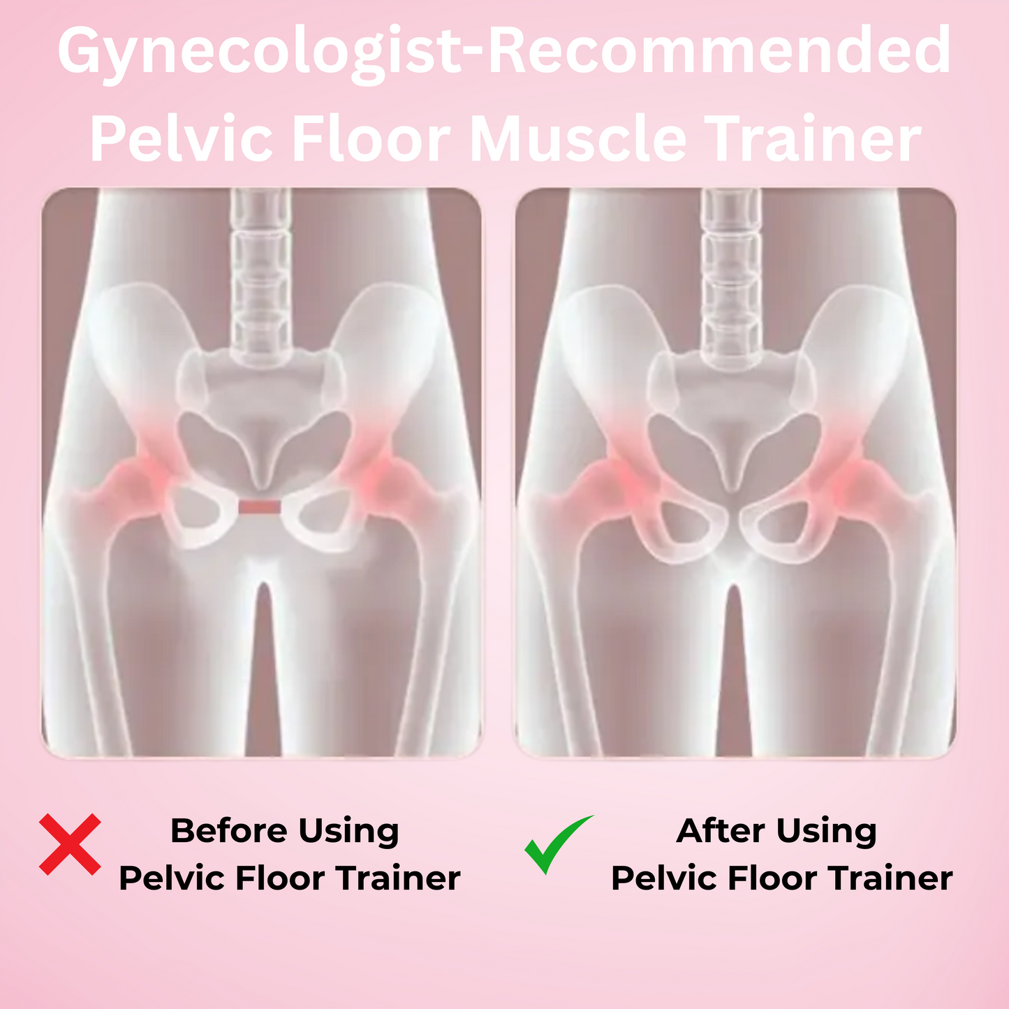 Pelvic Floor Muscle Trainer