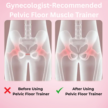 Pelvic Floor Muscle Trainer